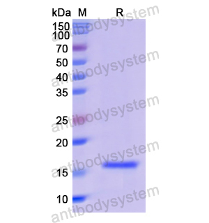Recombinant Human PLA2G1B, N-His
