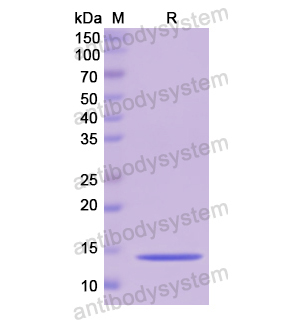 Recombinant Human CSTB, N-His