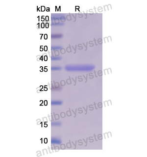 Recombinant Human OAT, N-His
