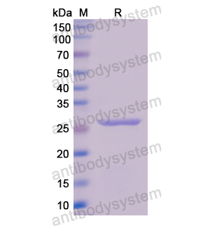 Recombinant Human TK1, N-His