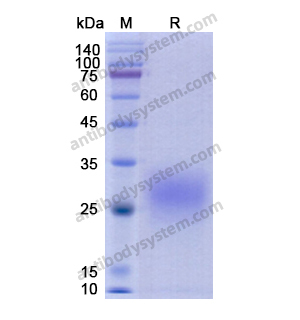 Recombinant Human CD74, C-His