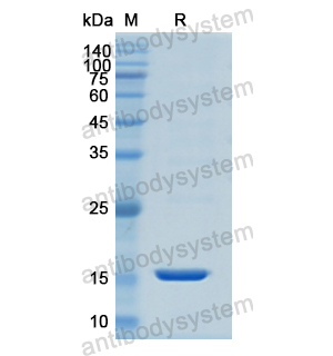 Recombinant Human KRT1, N-His