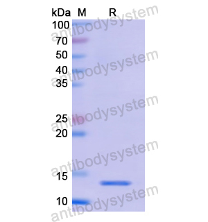 Recombinant Human S100B, N-His