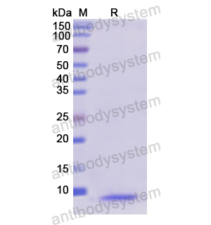 Recombinant Human MT1A, N-His