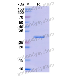 Recombinant Human CYP1A1, N-His