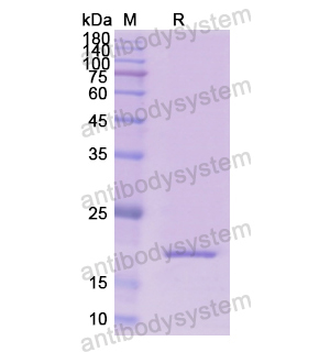 Recombinant Human RPN1, N-His