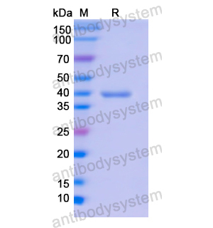 Recombinant Human CD236/GYPC, N-GST