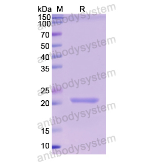 Recombinant Human APOD, N-His
