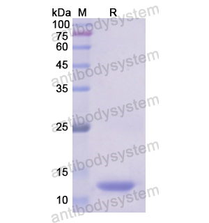Recombinant Human ALDH2, N-His