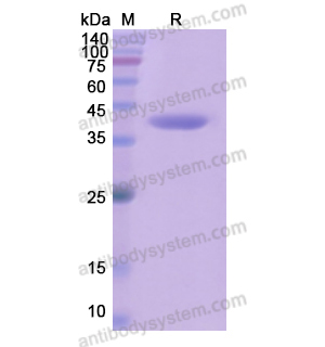 Recombinant Human CYP17A1, N-His
