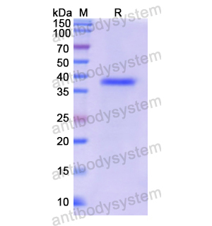 Recombinant Human CYP11A1, N-His
