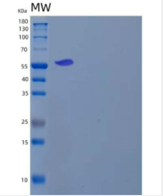 Recombinant Human CaM Kinase II Subunit β/CAMK2B Protein(C-6His)