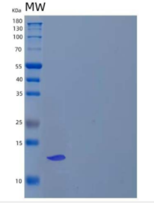 Recombinant Human S100 Calcium Binding Protein P/S100-P Protein(N-6His)