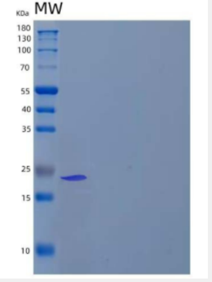Recombinant Human Magnesium-Dependent Phosphatase 1/MDP1 Protein(C-6His)