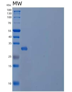 Recombinant Human Carbonic Anhydrase 5B/CA5B Protein(C-6His)