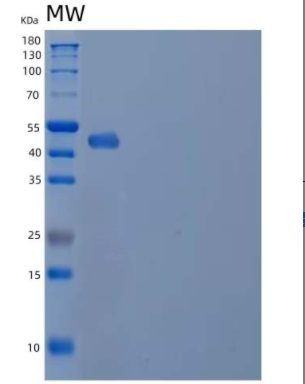 Recombinant Human Mannoside Acetylglucosaminyltransferase 2/GlcNAc-TII Protein(C-6His)
