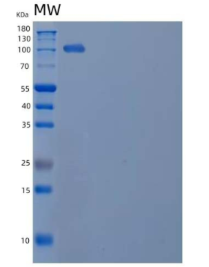 Recombinant Human Semaphorin-4B/SEMA4B Protein(C-Fc-6His)