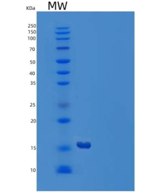 Recombinant Human GABA Receptor-Associated Protein-Like 1/GABARAPL1 Protein(N-6His)