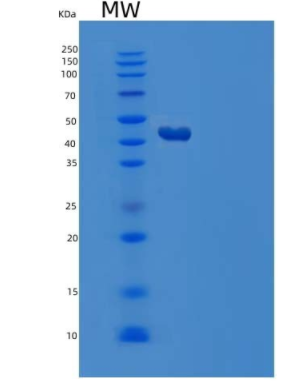 Recombinant Human Serpin A4/Kallistatin Protein(C-6His)