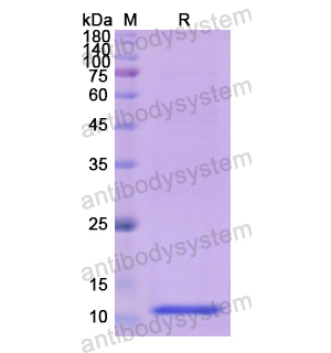 Recombinant Human HMGN1, N-His