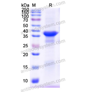 Recombinant Human SERPINA5, N-His