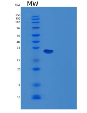 Recombinant Mouse Carbonic Anhydrase 12/CA12 Protein(C-6His)
