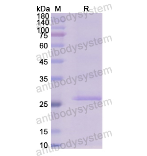 Recombinant Human PCCB, N-His