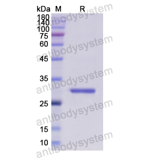 Recombinant Human EIF2S1, N-His