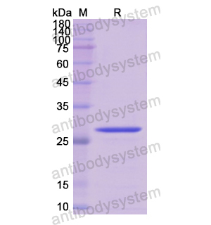 Recombinant Human JUN, N-His