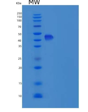 Recombinant Human CST9L / Testatin Protein (Fc tag)