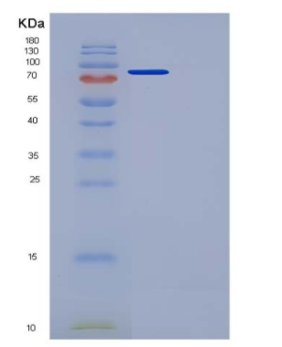 Recombinant Mouse Semaphorin 3A / SEMA3A Protein (Fc tag)