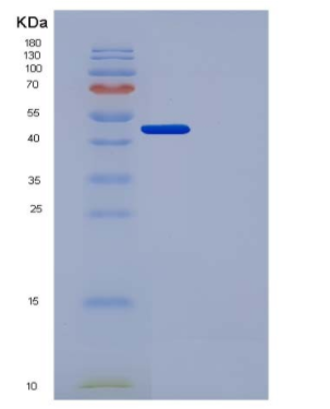 Recombinant Human Urokinase / uPA Protein (His Tag)