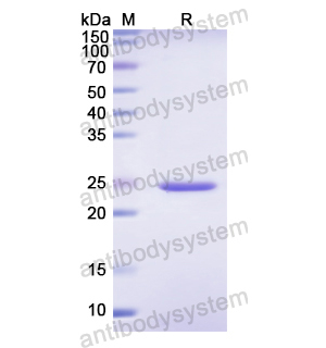 Recombinant Human SSB, N-His
