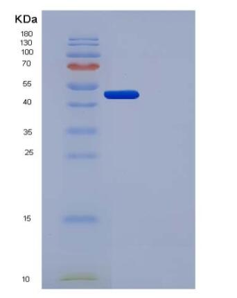 Recombinant Human Urokinase / PLAU Protein (His tag)