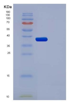 Recombinant Human AKR1A1 Protein (His tag)