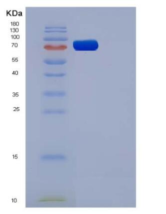 Recombinant Rat VEGFR1 / FLT-1 Protein (His tag)