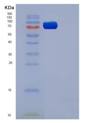 Recombinant Mouse VEGFR3 / FLT-4 Protein (His tag)