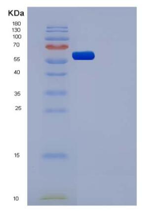 Recombinant Human CSF1R / MCSF Receptor / CD115 Protein (His tag)