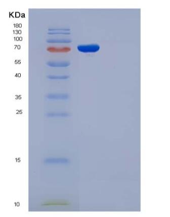 Recombinant Rat gp130 / IL6ST / CD130 Protein (His & Fc tag)