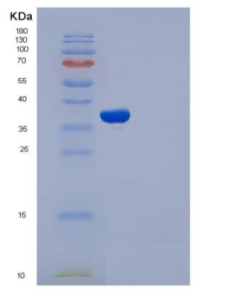 Recombinant Rat IL1R1 / CD121a Protein (His tag)