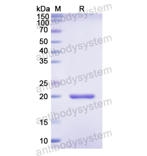 Recombinant Human KRT18, N-His