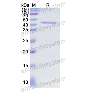 Recombinant Human RB1, N-GST