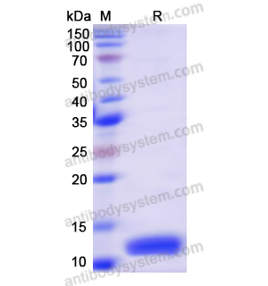 Recombinant Human S100A6, N-His