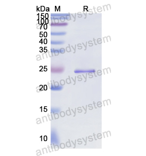 Recombinant Human CD66e/CEA/CEACAM5, N-His