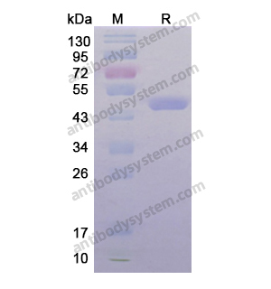 Recombinant Human CKM, N-His