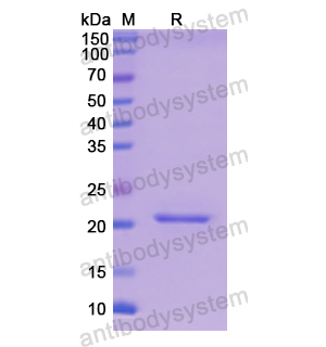 Recombinant Human PYGL, N-His