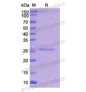 Recombinant Human GPI, N-His