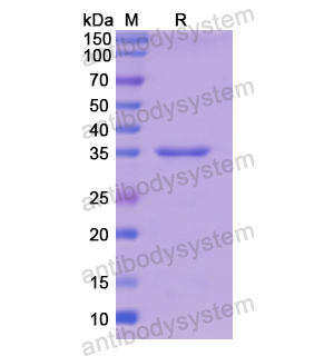 Recombinant Human TPM3, N-His