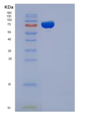 Recombinant Human Complement C5a Protein