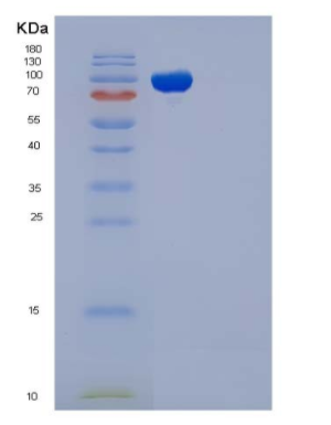 Recombinant Mouse ICAM-1 / CD54 Protein (His & Fc tag)